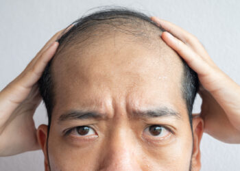 Hair Loss Treatment Mumbai, India (QR678)