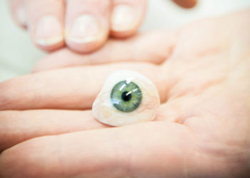 Artificial Prosthetic (False) Eye Fitting Post Enucleation Evisceration Eye Removal Surgery