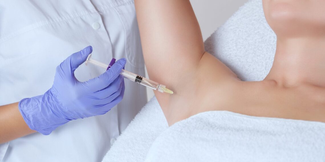 Botox Injections for Severe Sweating (Hyperhidrosis)