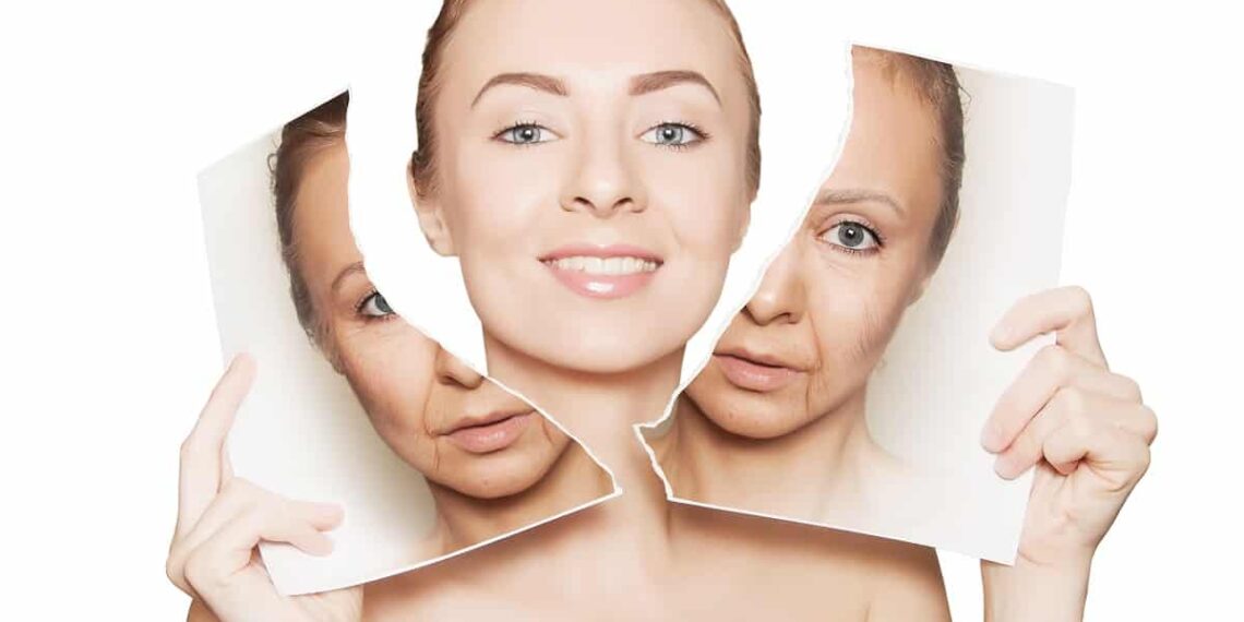 Nasolabial Folds Treatment