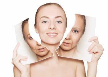 Nasolabial Folds Treatment