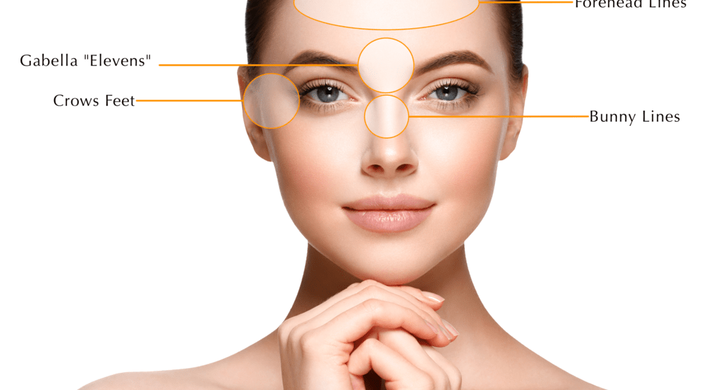 Botox injection and its uses