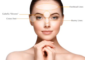 Botox injection and its uses