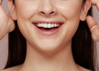 Nasolabial folds treatment