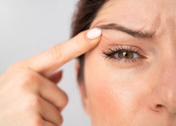 How to treat droopy eyes?