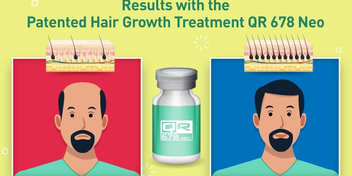 Best Hair Treatment in Mumbai, India