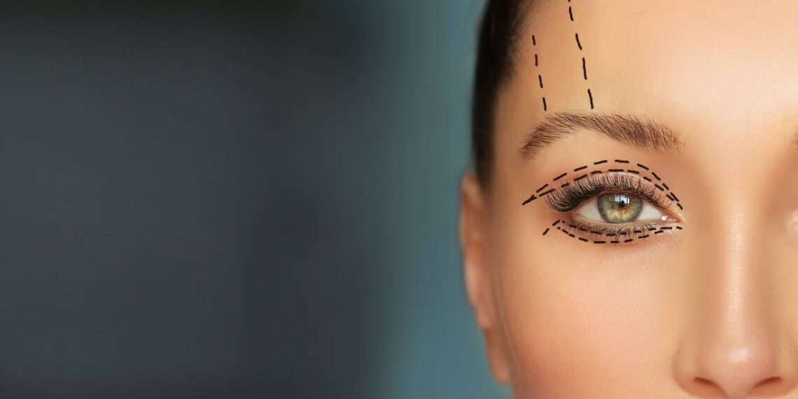 Best treatment for droopy eyelids