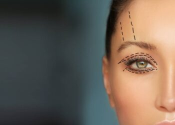 Best treatment for droopy eyelids