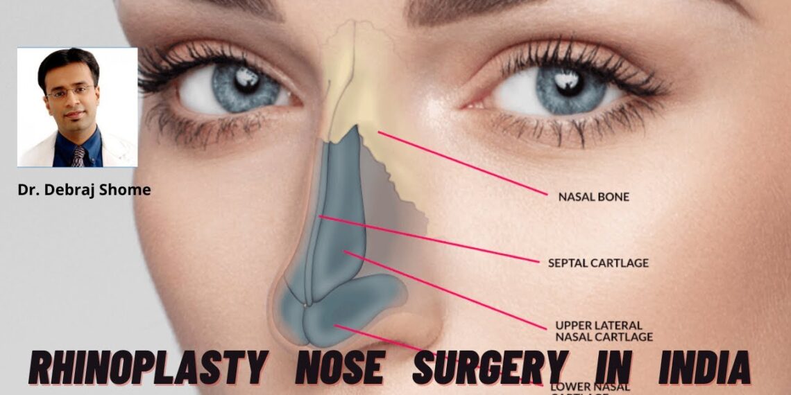 Best Rhinoplasty Surgeon in India