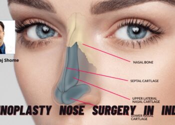 Best Rhinoplasty Surgeon in India