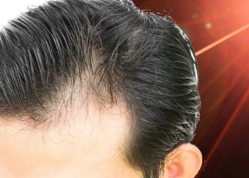 Get assured solutions for all your hair problems with the best hair treatment in Mumbai