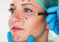 How to Choose the Right Cosmetic Surgeon