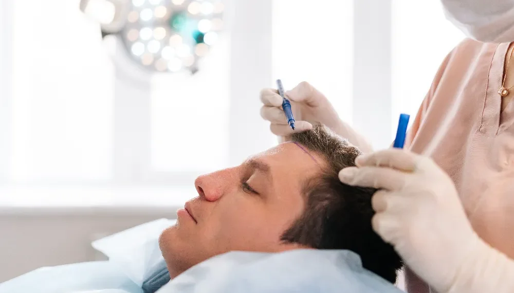hair transplant surgery