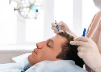 hair transplant surgery