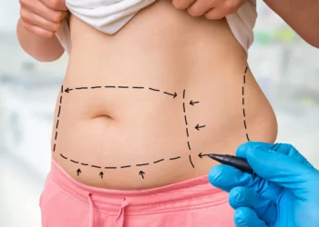 Tummy Tuck Surgery in India