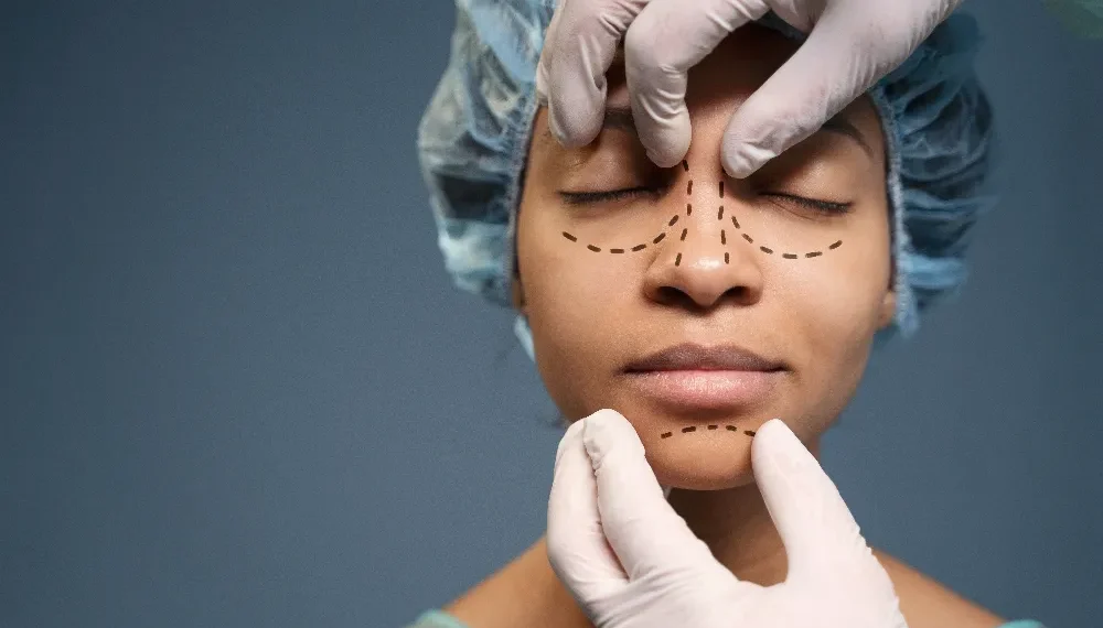 nose plastic surgery