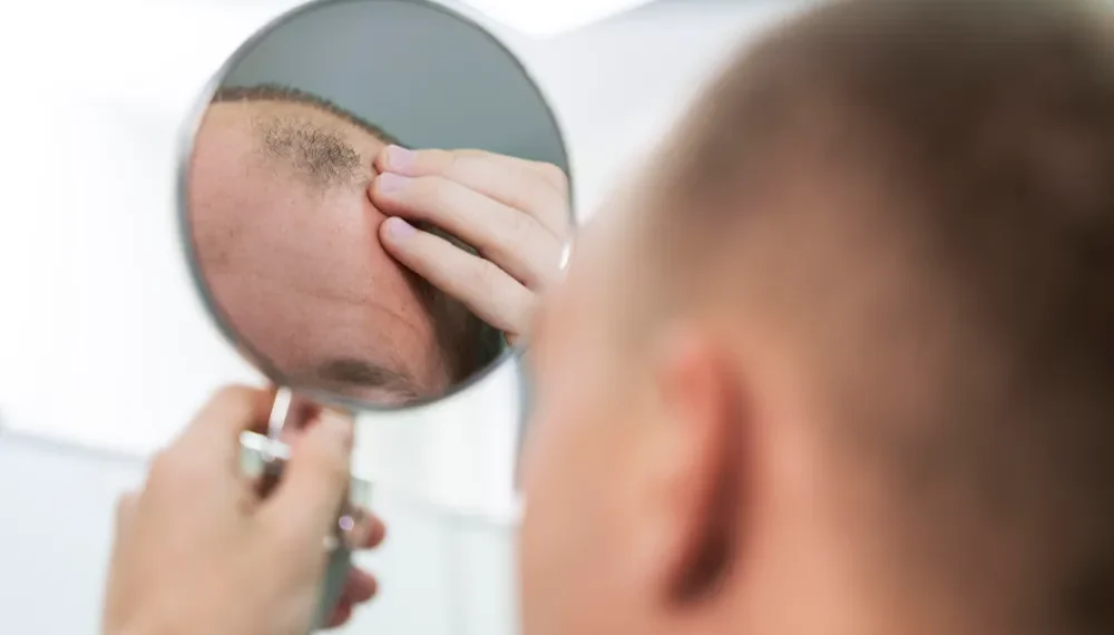 best hair transplant surgeon
